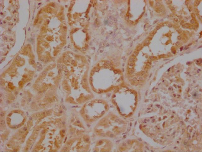 USP30 Antibody in Immunohistochemistry (Paraffin) (IHC (P))