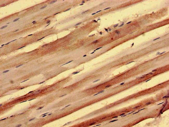 PPP1R3B Antibody in Immunohistochemistry (Paraffin) (IHC (P))