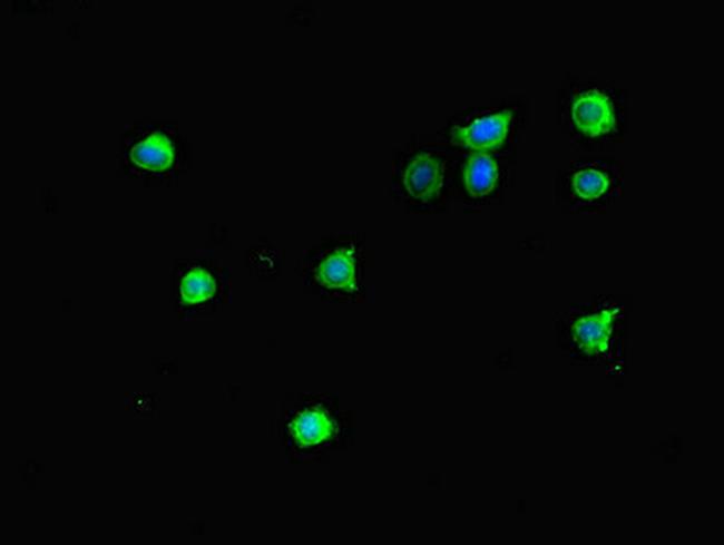 MTERFD2 Antibody in Immunocytochemistry (ICC/IF)