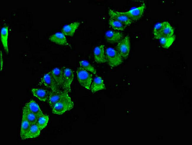 SULF2 Antibody in Immunocytochemistry (ICC/IF)