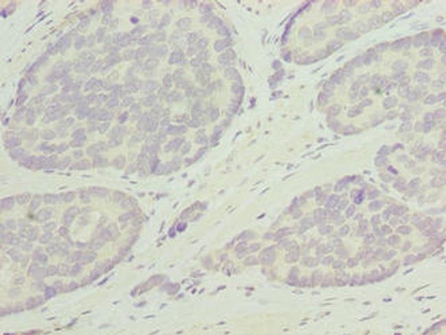 ODF3L1 Antibody in Immunohistochemistry (Paraffin) (IHC (P))