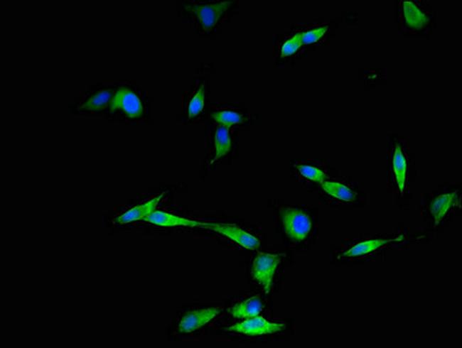 DYNC2H1 Antibody in Immunocytochemistry (ICC/IF)