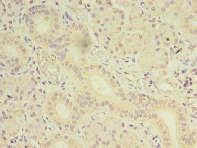 OSR2 Antibody in Immunohistochemistry (Paraffin) (IHC (P))