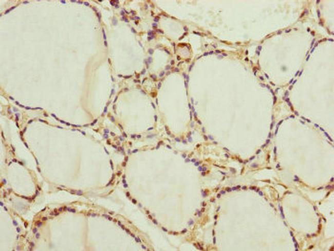 NEDD1 Antibody in Immunohistochemistry (Paraffin) (IHC (P))