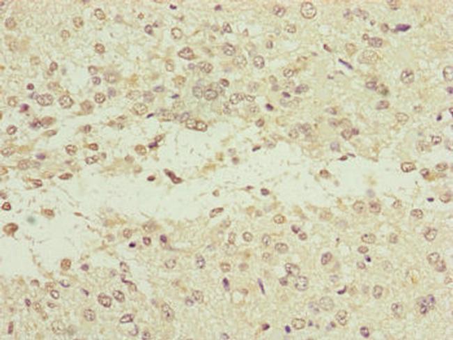 NEDD1 Antibody in Immunohistochemistry (Paraffin) (IHC (P))