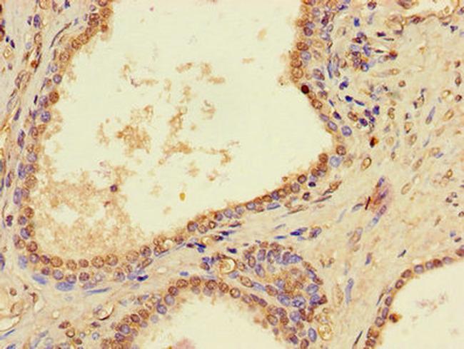 PTCD2 Antibody in Immunohistochemistry (Paraffin) (IHC (P))