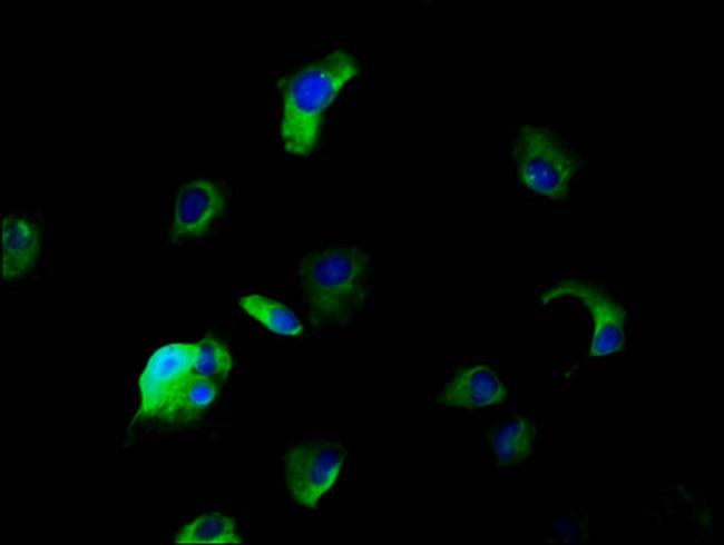 SLC5A5 Antibody in Immunocytochemistry (ICC/IF)