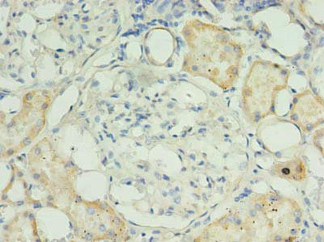 RPUSD4 Antibody in Immunohistochemistry (Paraffin) (IHC (P))