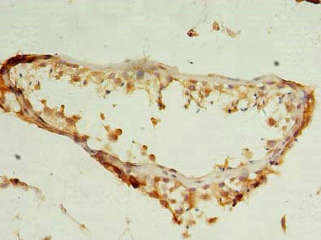 NUDT11 Antibody in Immunohistochemistry (Paraffin) (IHC (P))