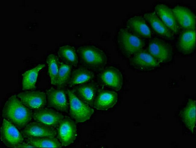 VPS39 Antibody in Immunocytochemistry (ICC/IF)