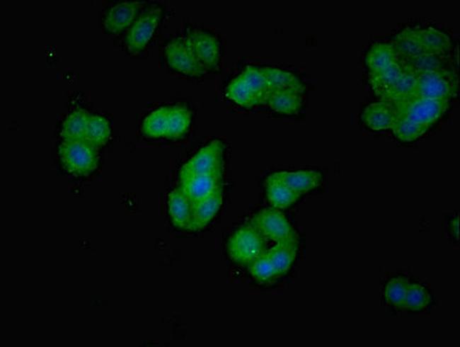 PDCL2 Antibody in Immunocytochemistry (ICC/IF)