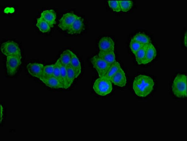 BBS1 Antibody in Immunocytochemistry (ICC/IF)