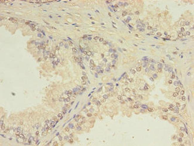 CEP63 Antibody in Immunohistochemistry (Paraffin) (IHC (P))