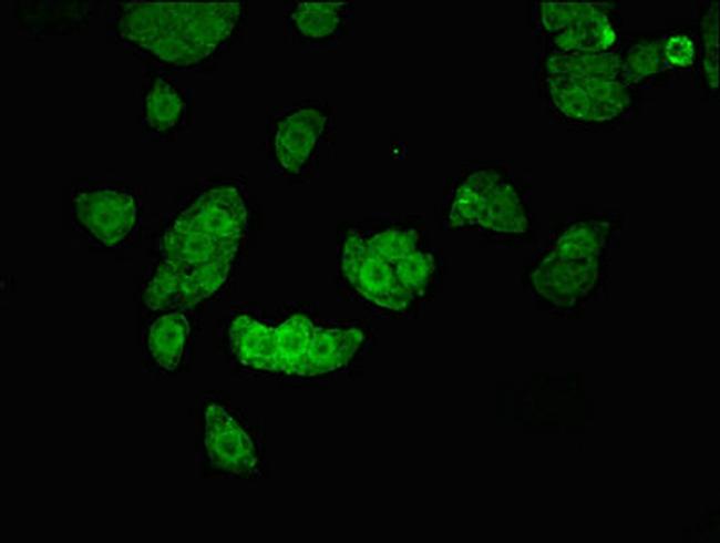 UHMK1 Antibody in Immunocytochemistry (ICC/IF)