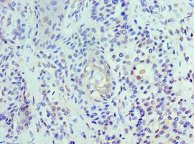 UBE2J2 Antibody in Immunohistochemistry (Paraffin) (IHC (P))