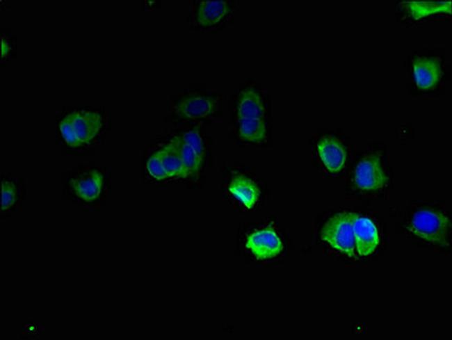 TBC1D20 Antibody in Immunocytochemistry (ICC/IF)