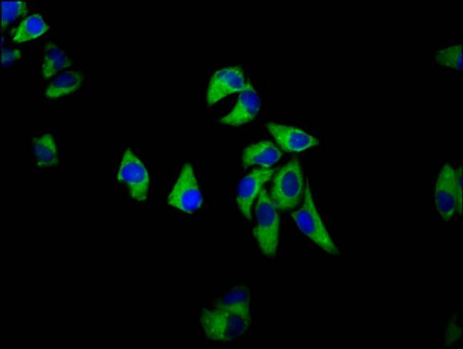 SEMA6D Antibody in Immunocytochemistry (ICC/IF)