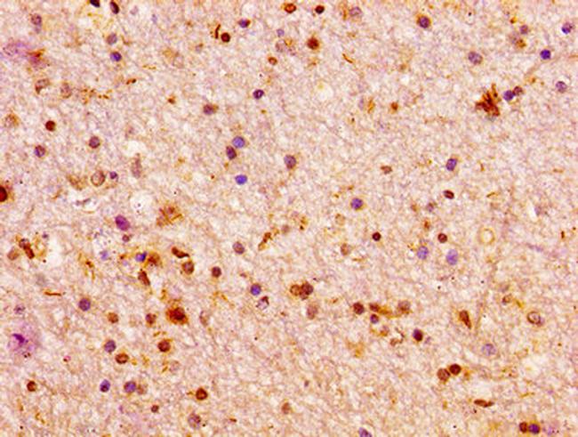 ARX Antibody in Immunohistochemistry (Paraffin) (IHC (P))