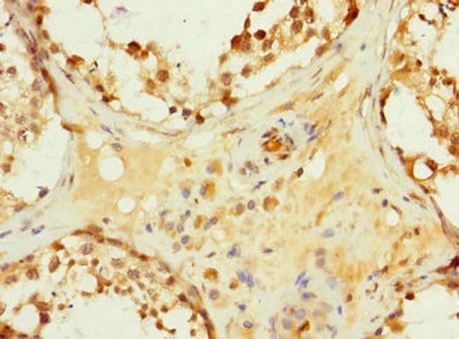 HHIP Antibody in Immunohistochemistry (Paraffin) (IHC (P))