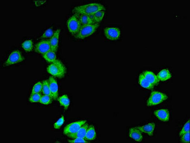 Amisyn Antibody in Immunocytochemistry (ICC/IF)