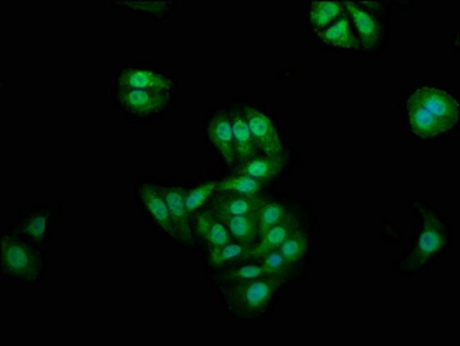 Naked1 Antibody in Immunocytochemistry (ICC/IF)