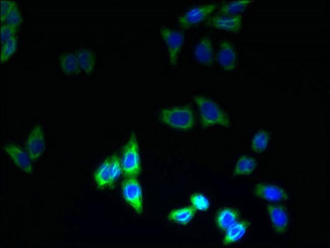 PQLC3 Antibody in Immunocytochemistry (ICC/IF)