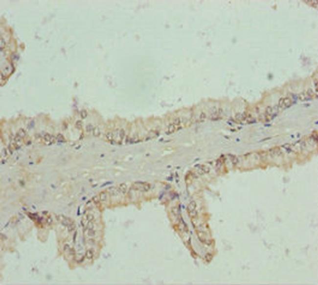 RNF34 Antibody in Immunohistochemistry (Paraffin) (IHC (P))