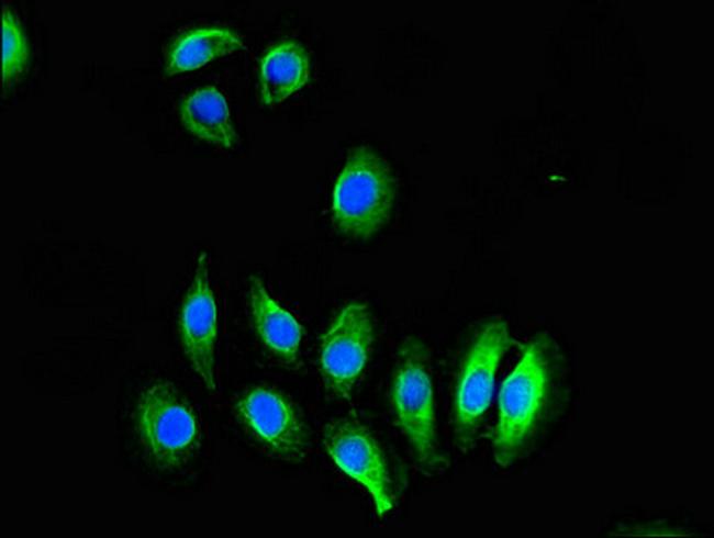 CREB3L1 Antibody in Immunocytochemistry (ICC/IF)