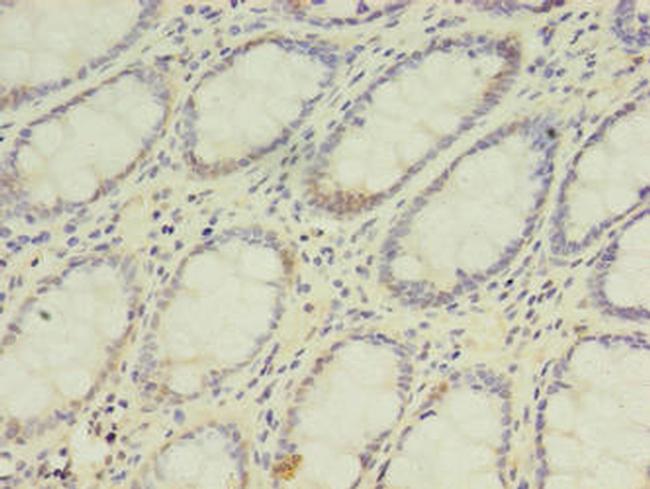 DPH2 Antibody in Immunohistochemistry (Paraffin) (IHC (P))