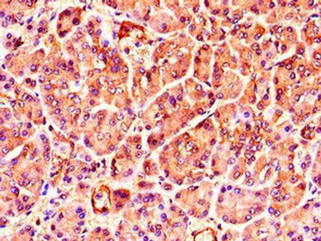 TNRC6C Antibody in Immunohistochemistry (Paraffin) (IHC (P))