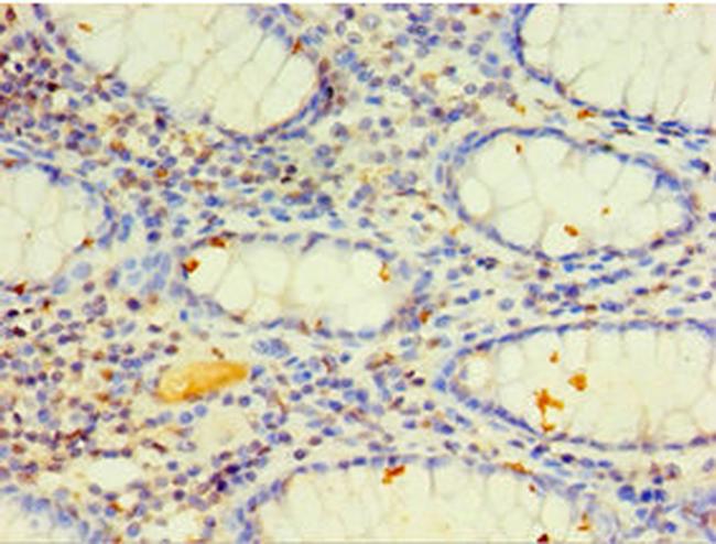 CYP4F12 Antibody in Immunohistochemistry (Paraffin) (IHC (P))