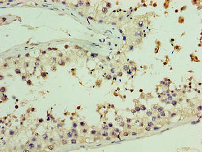 AASDHPPT Antibody in Immunohistochemistry (Paraffin) (IHC (P))