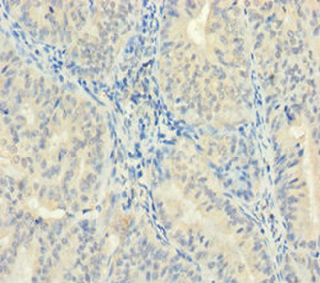 ZMAT5 Antibody in Immunohistochemistry (Paraffin) (IHC (P))