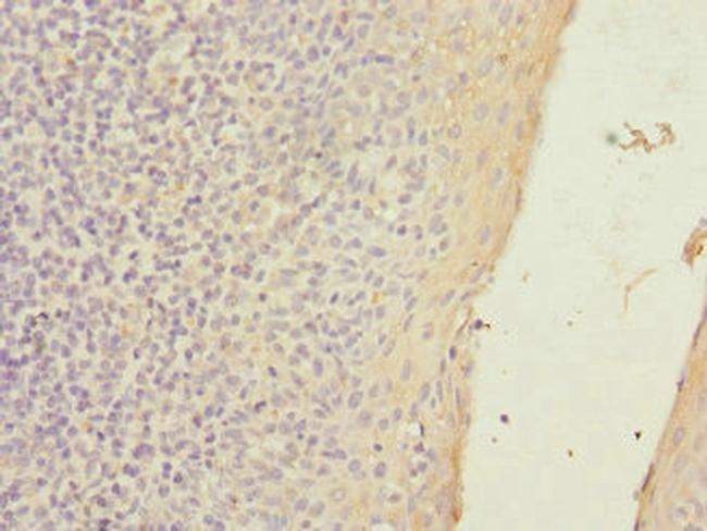 SLC23A2 Antibody in Immunohistochemistry (Paraffin) (IHC (P))