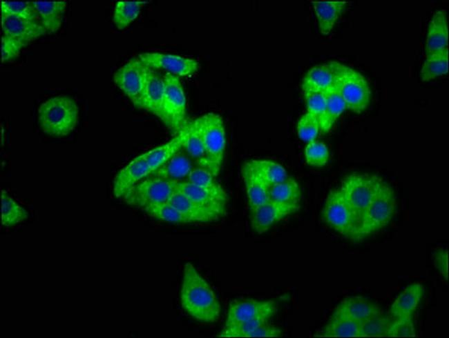 SEMA4B Antibody in Immunocytochemistry (ICC/IF)