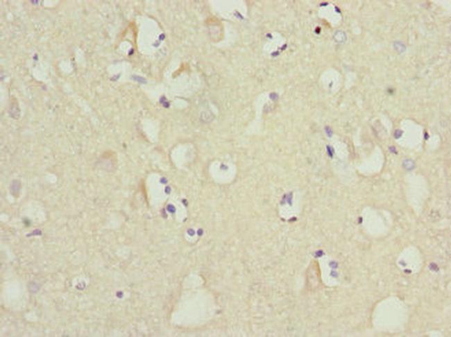 MTCH1 Antibody in Immunohistochemistry (Paraffin) (IHC (P))