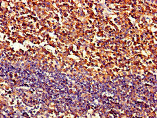 PIPOX Antibody in Immunohistochemistry (Paraffin) (IHC (P))