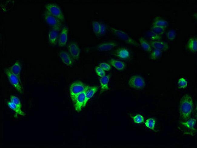 CYP4F11 Antibody in Immunocytochemistry (ICC/IF)