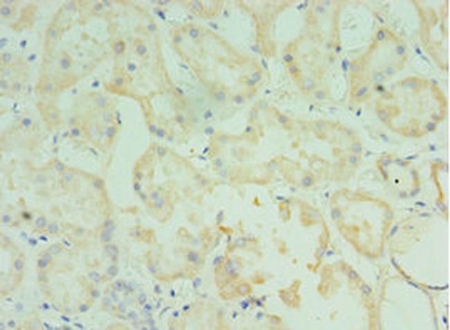 TMOD3 Antibody in Immunohistochemistry (Paraffin) (IHC (P))