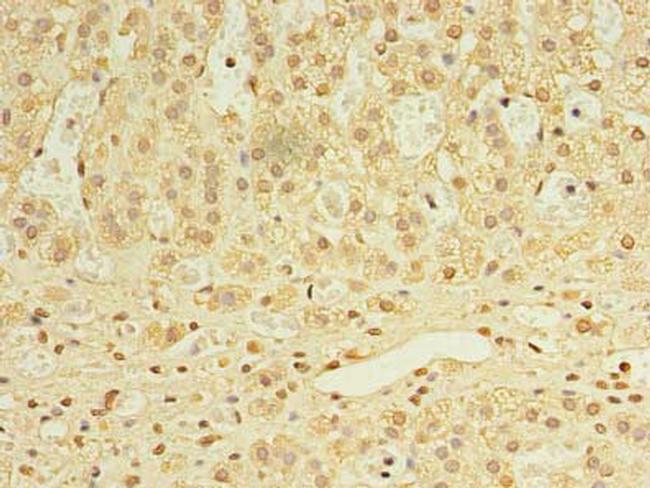 UTP23 Antibody in Immunohistochemistry (Paraffin) (IHC (P))