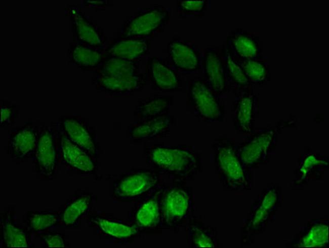 NPL Antibody in Immunocytochemistry (ICC/IF)