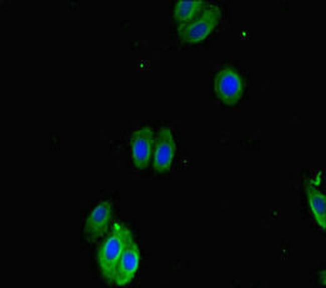 SMOC1 Antibody in Immunocytochemistry (ICC/IF)