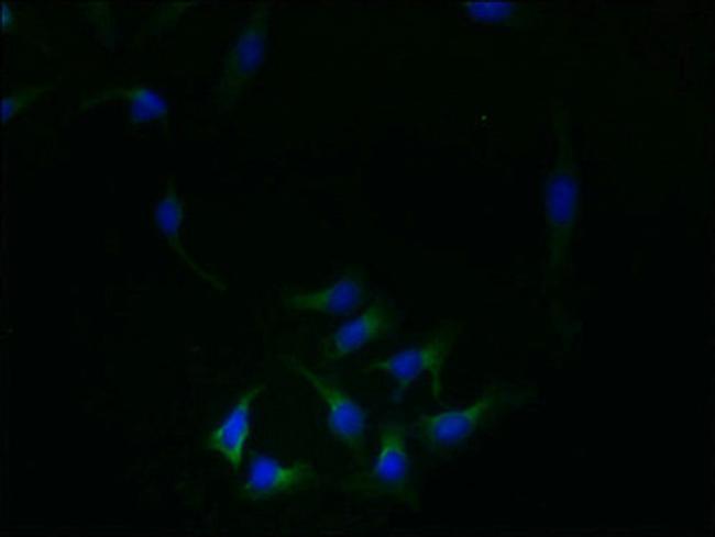 REEP4 Antibody in Immunocytochemistry (ICC/IF)