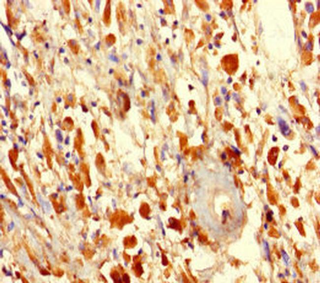 F1142 Antibody in Immunohistochemistry (Paraffin) (IHC (P))