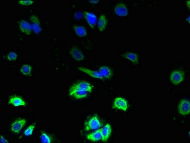 ZDHC3 Antibody in Immunocytochemistry (ICC/IF)