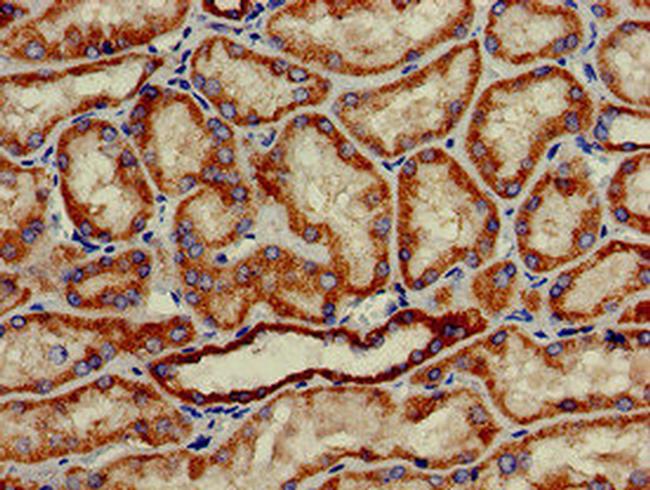 HAO2 Antibody in Immunohistochemistry (Paraffin) (IHC (P))