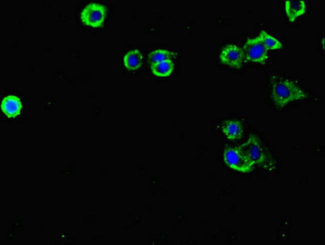 FLRT3 Antibody in Immunocytochemistry (ICC/IF)