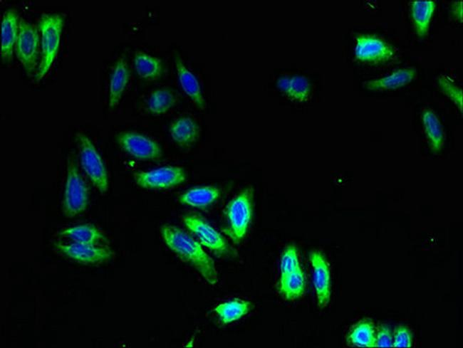 NMUR1 Antibody in Immunocytochemistry (ICC/IF)