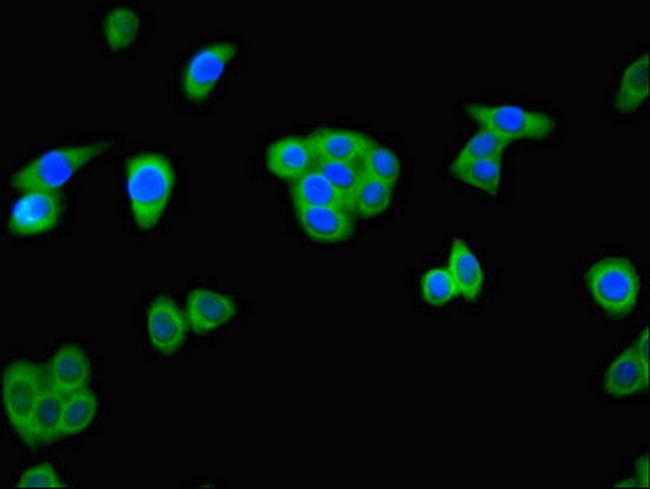 ALKBH4 Antibody in Immunocytochemistry (ICC/IF)