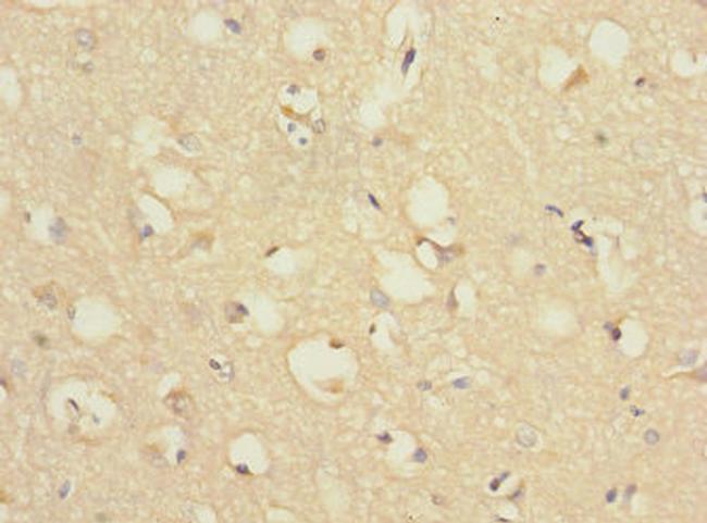 CHRNA9 Antibody in Immunohistochemistry (Paraffin) (IHC (P))